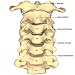 Degeneratívne ochorenie krčnej chrbtice (etiológia, patofyziológia, diagnostika a chirurgická liečba)
