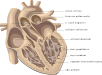 Ischemic heart disease