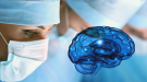 Neurochirurgia - vybrané témy