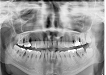 Protetické zubné lekárstvo - 3. ročník