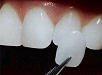 Protetické zubné lekárstvo - 4. ročník