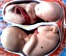 Základy gynekológie a pôrodníctva I